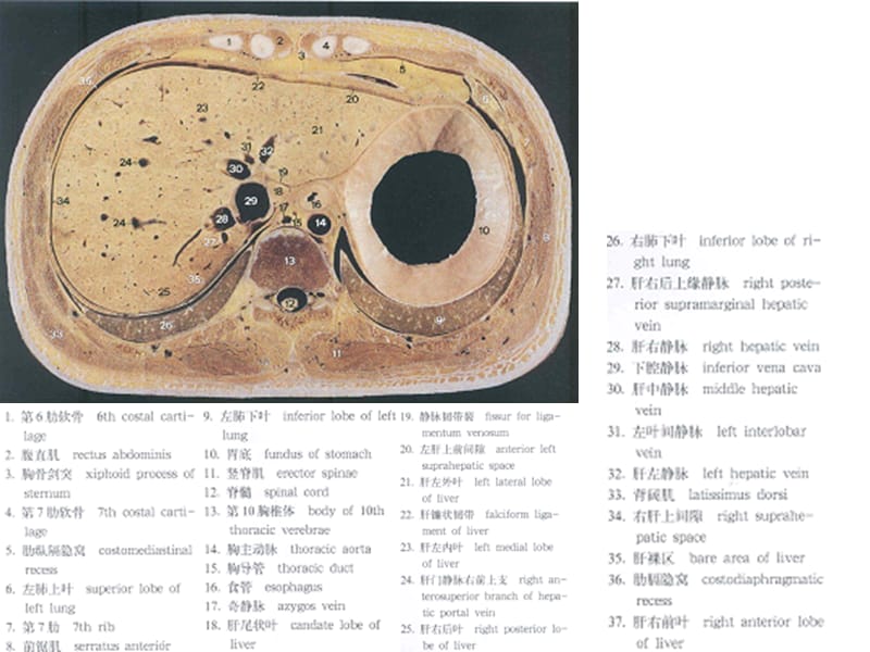 最新腹部断层彩色解剖和CT-PPT文档.ppt_第3页