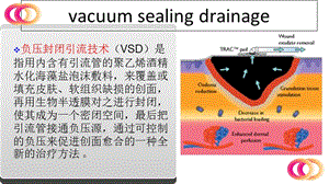 最新：vsd护理查房-文档资料.ppt