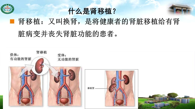 最新肾移植术后并发症2ppt课件-PPT文档.ppt_第1页