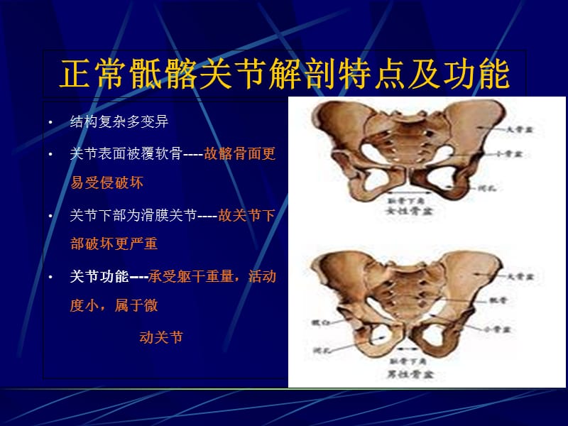 AS骶髂关节病变的CT诊断-文档资料.ppt_第1页