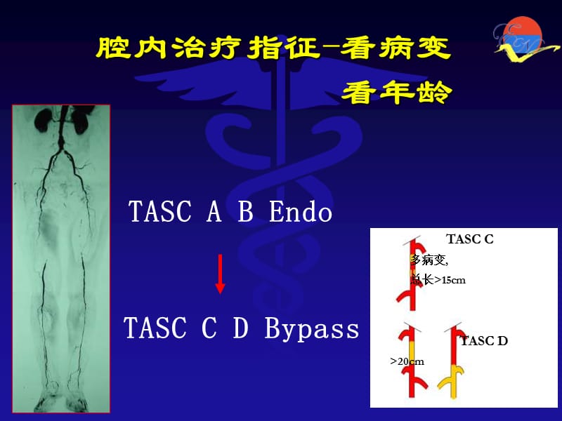 最新股浅动脉CTO的腔内治疗课件-PPT文档.ppt_第3页