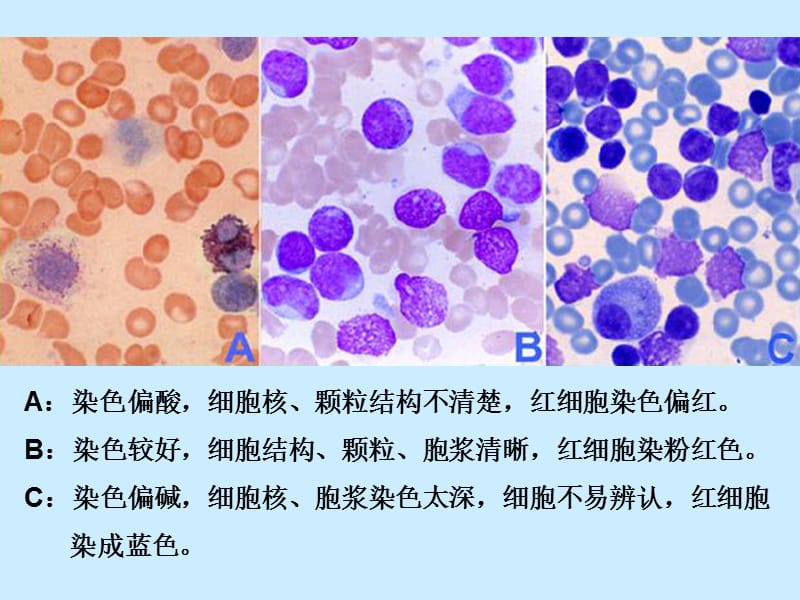 医学免疫学-外周血细胞形态的观察-重要！-PPT文档.ppt_第3页