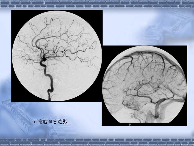 中枢神经系统第八版课件-PPT文档资料.ppt_第3页