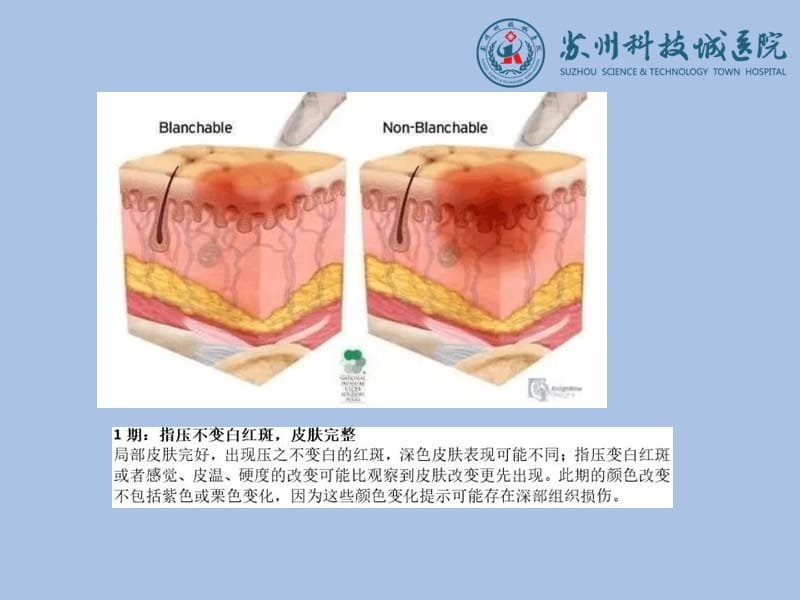 最新：伤口敷料的选择及应用ppt课件-文档资料.ppt_第2页