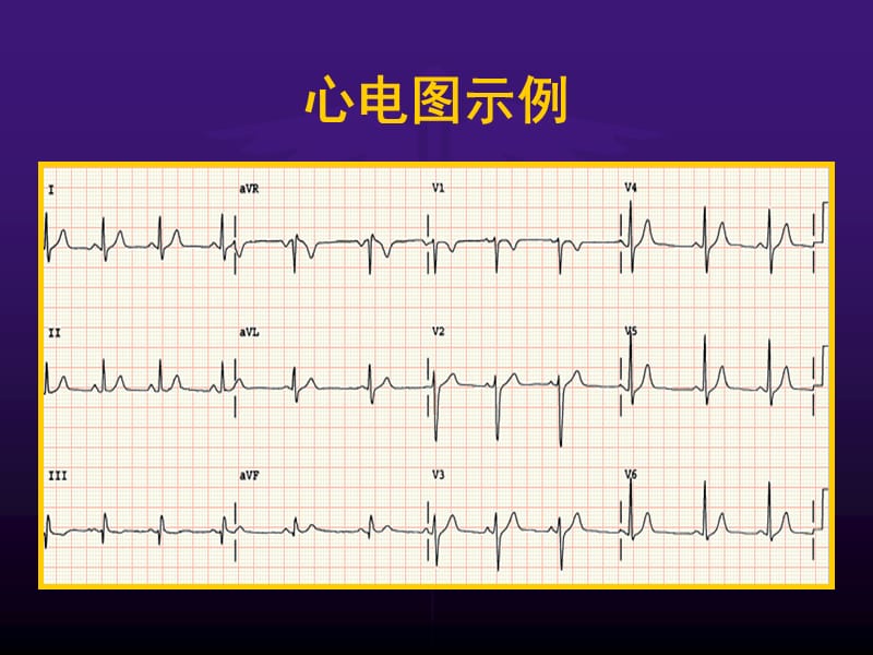 最新诊断学-心电图学上-PPT文档.ppt_第2页