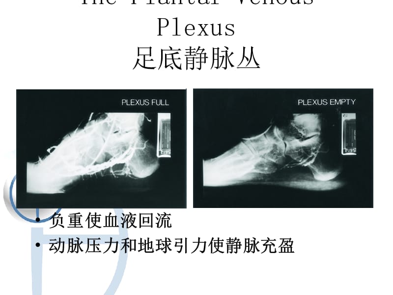 最新：动静脉（AV）脉冲系统课件-文档资料.ppt_第3页