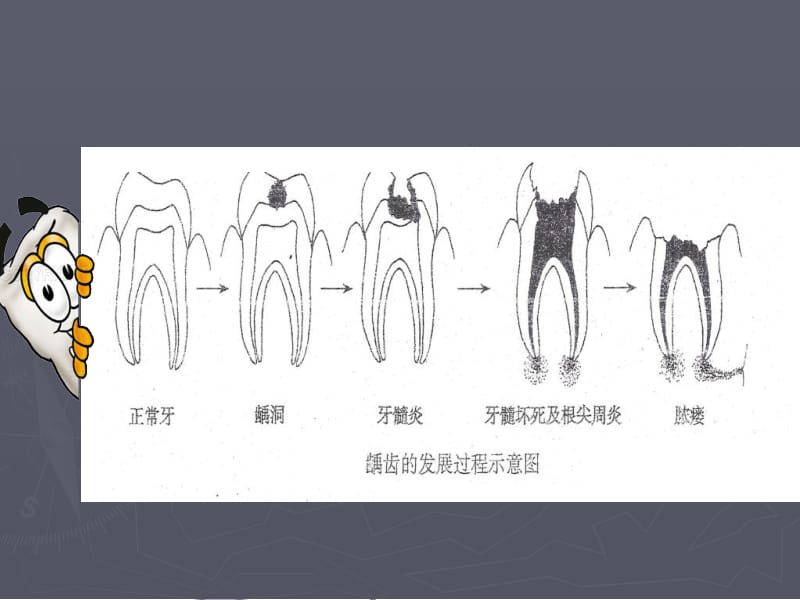 口腔科病人的护理-PPT文档.ppt_第3页