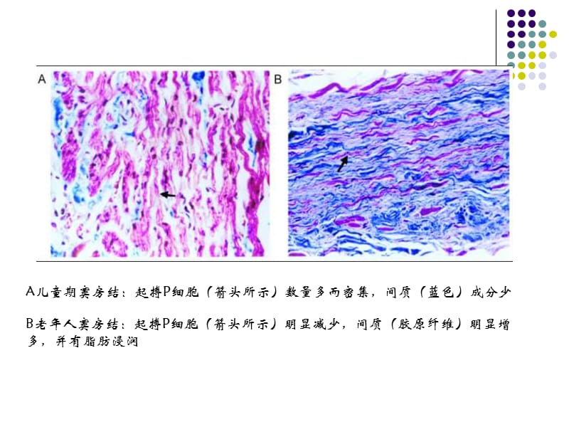 最新：老患者起搏器的过度治疗及处理-文档资料.ppt_第3页