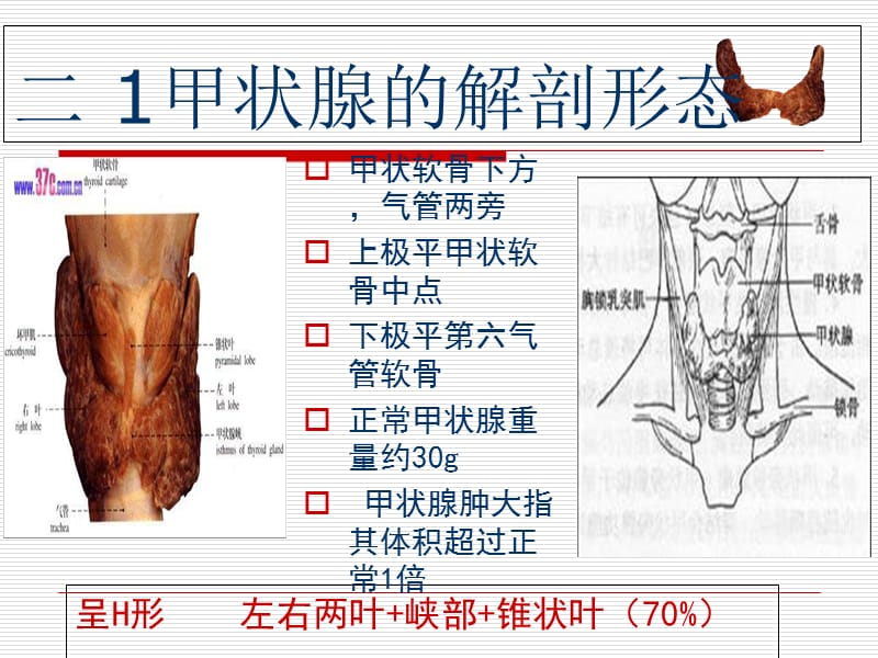 甲状腺肿瘤的护理-PPT文档.ppt_第2页