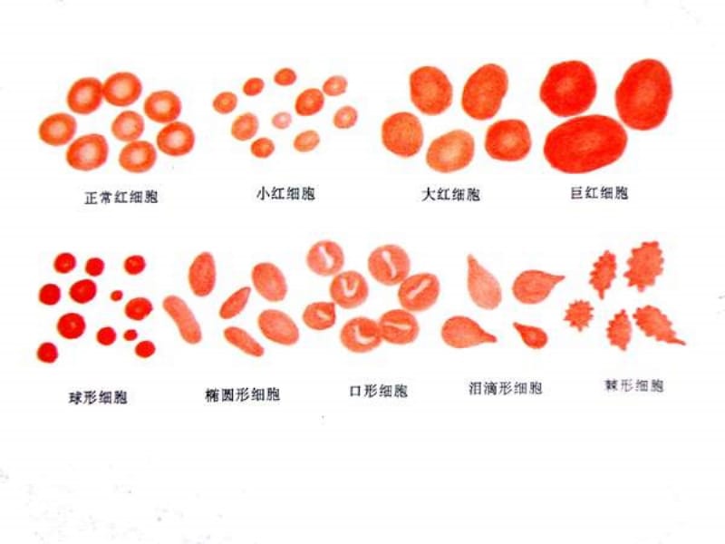 实验诊断学 细胞计数-PPT文档.ppt_第2页