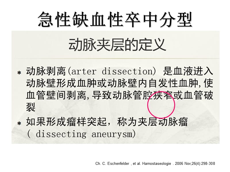 最新颈动脉夹层治疗的策略-PPT文档.ppt_第2页