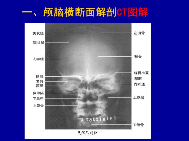 头颈部CT应用-PPT文档.ppt_第2页