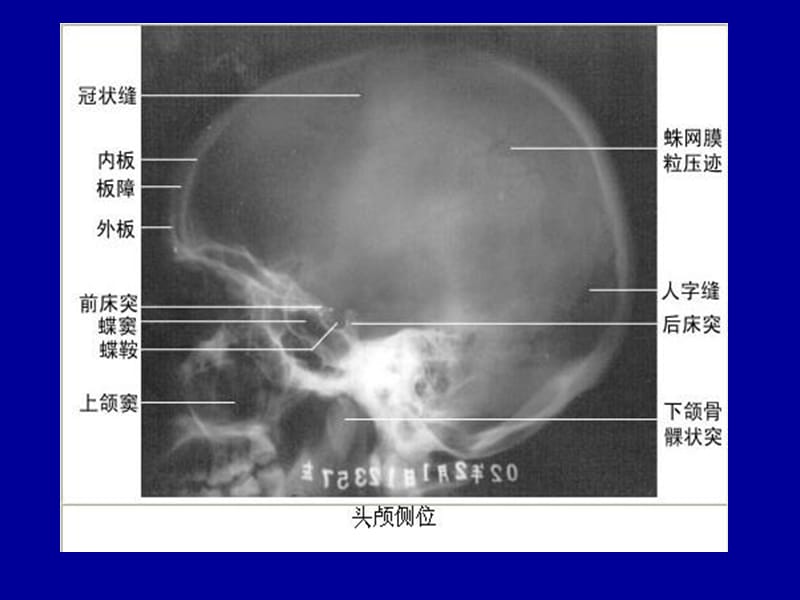 头颈部CT应用-PPT文档.ppt_第3页