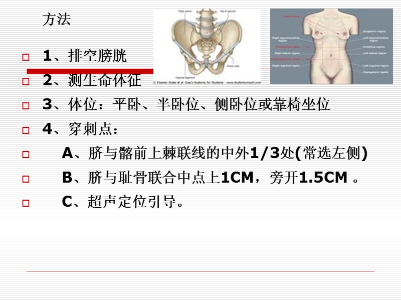 外科常用穿术课件-PPT文档.ppt_第2页