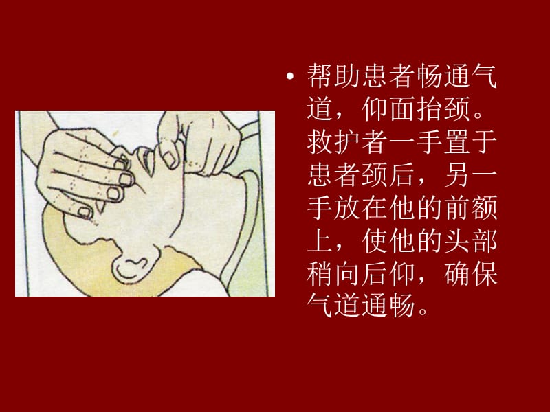 心脏复苏的基本方法-文档资料.ppt_第2页