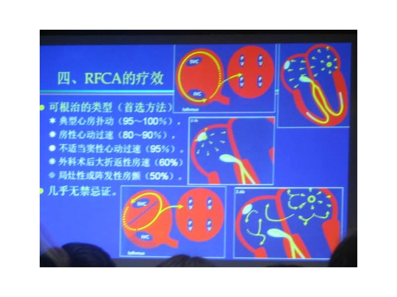 射频消融治疗快速房性心律失常-PPT文档资料.ppt_第3页