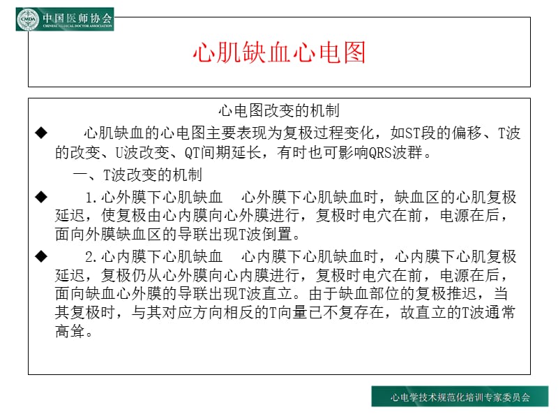 心肌缺血心电图规范化培训-PPT课件.ppt_第3页