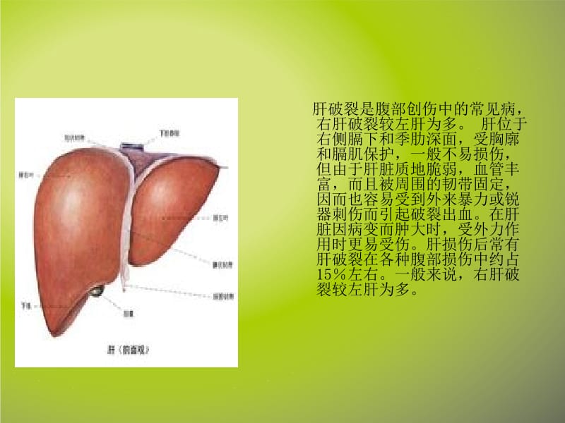 清爽绿色模版(4：3)-肝破裂的抢救与配合-精选文档.ppt_第2页