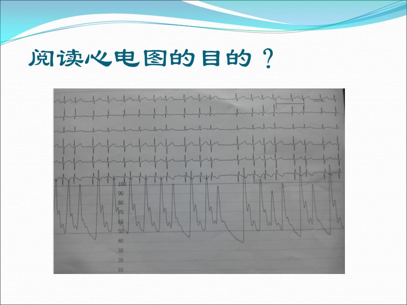 最新：如何阅读儿童心电图ppt课件-文档资料.ppt_第2页