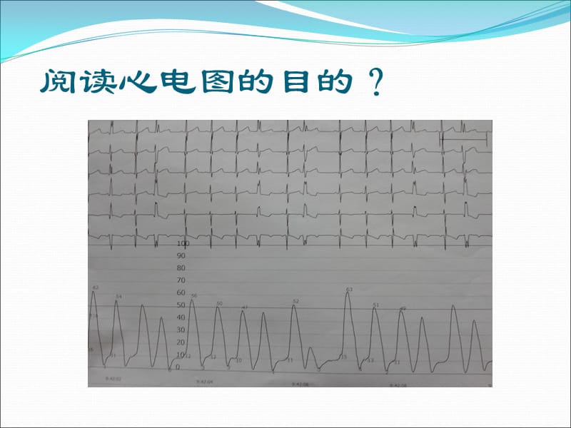 最新：如何阅读儿童心电图ppt课件-文档资料.ppt_第3页