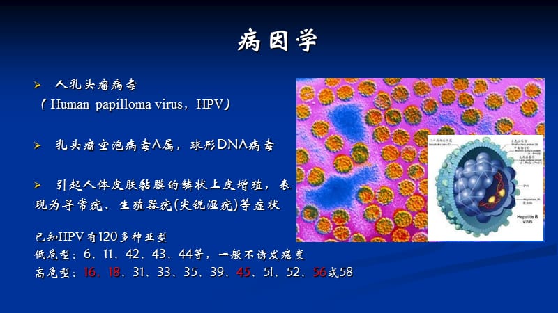 宫颈癌贾朝阳-精选文档.ppt_第2页