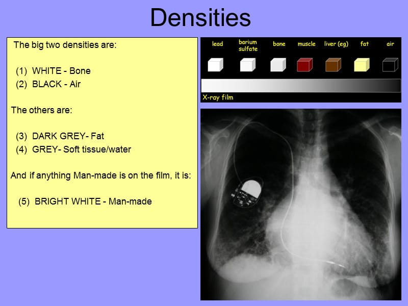 最新：The Chest X-Ray：胸部X光检查-文档资料.ppt_第3页