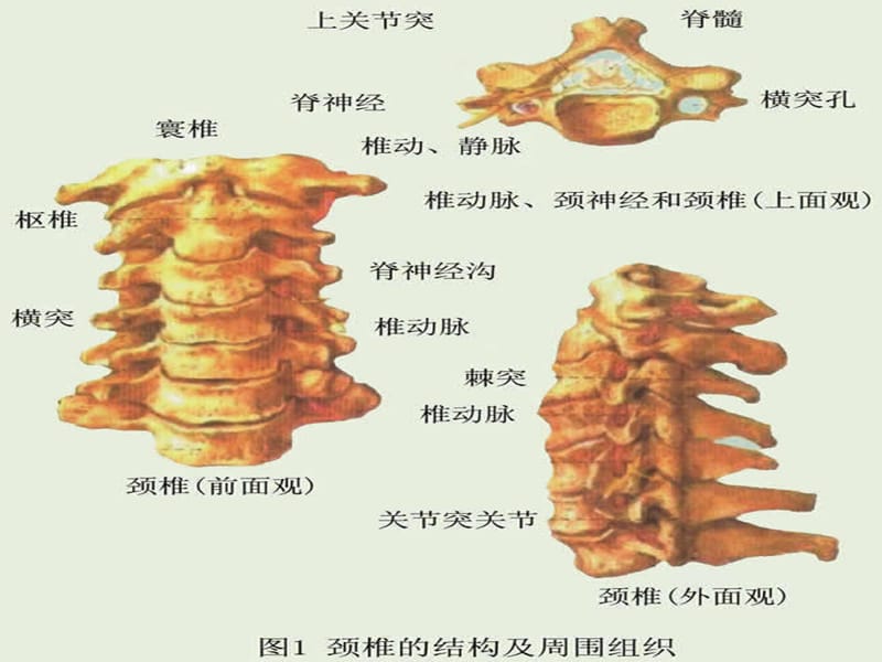 最新颈椎X线诊断-判断椎体退变的步骤-PPT文档.ppt_第2页