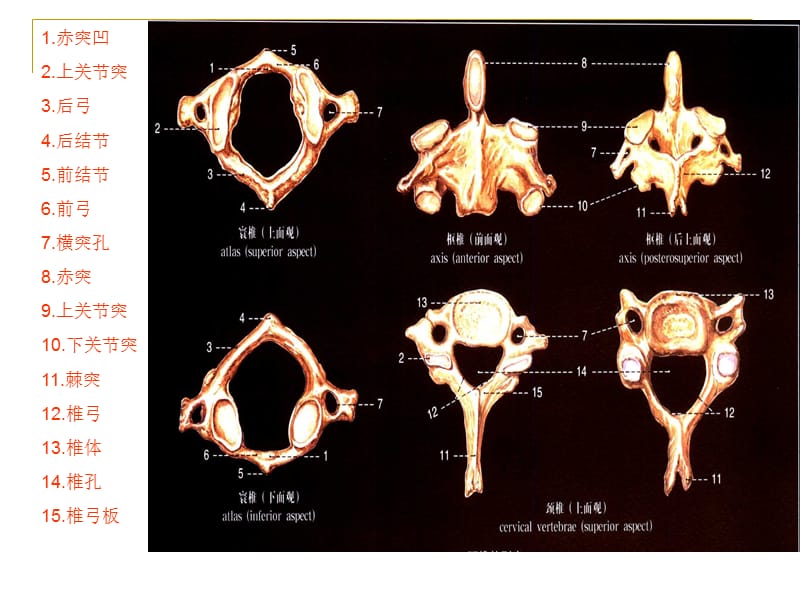 最新颈椎X线诊断-判断椎体退变的步骤-PPT文档.ppt_第3页
