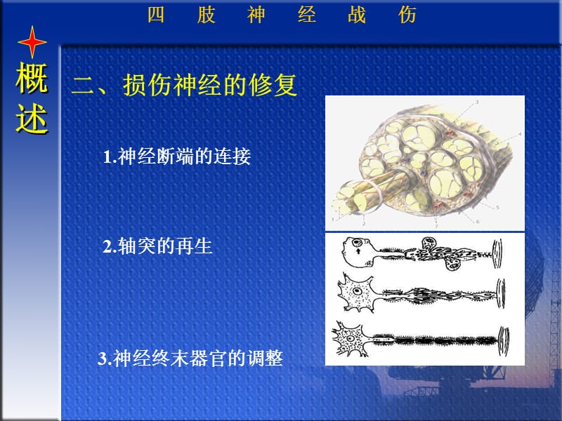 四肢神经战伤-文档资料.ppt_第3页