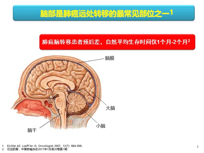 最新：肺癌脑转移诊治ppt课件-文档资料.ppt_第3页