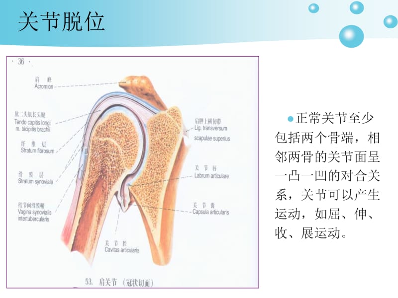 最新：关节脱位病人的护理-文档资料.ppt_第2页