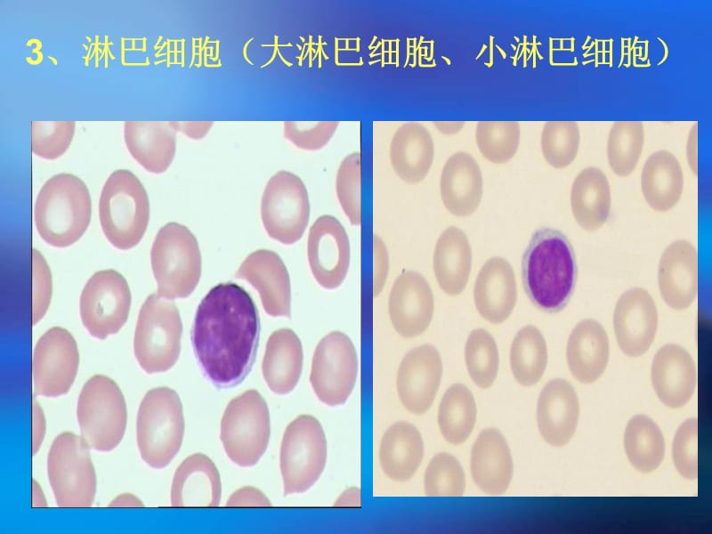 最新：外周血常见细胞形态-文档资料.ppt_第2页