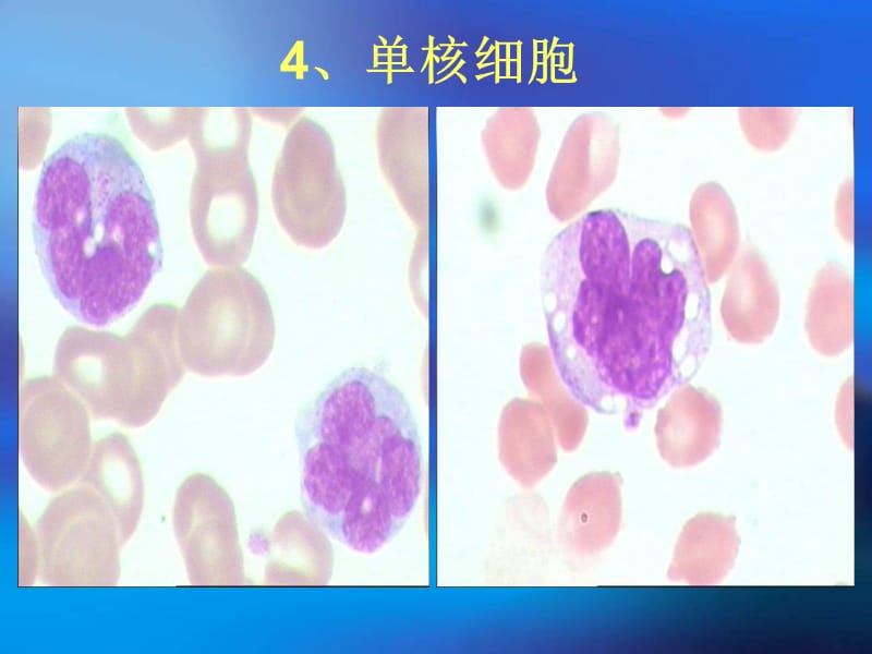 最新：外周血常见细胞形态-文档资料.ppt_第3页