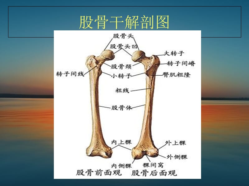 最新：股骨骨折-文档资料.ppt_第1页