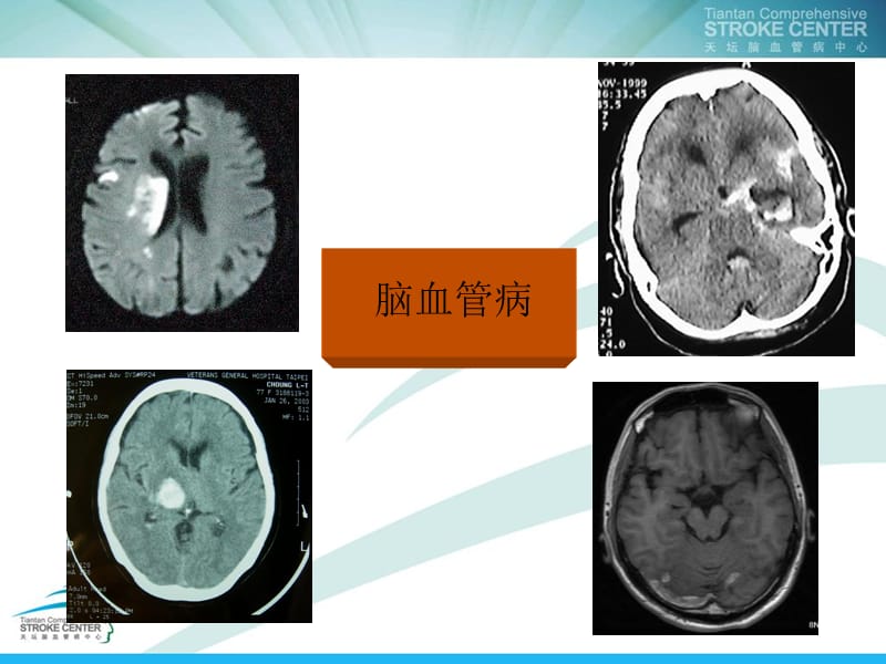 常见神经系统疾病诊治思路-精选文档.ppt_第2页