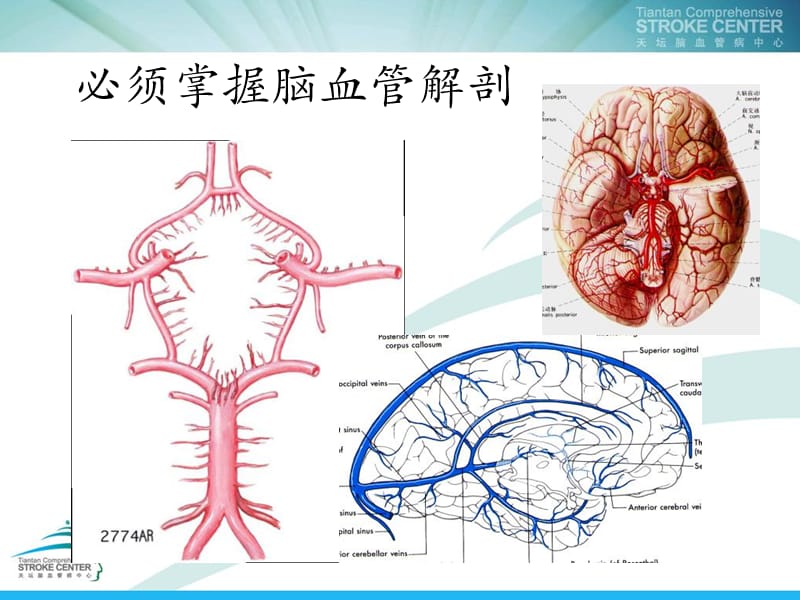 常见神经系统疾病诊治思路-精选文档.ppt_第3页