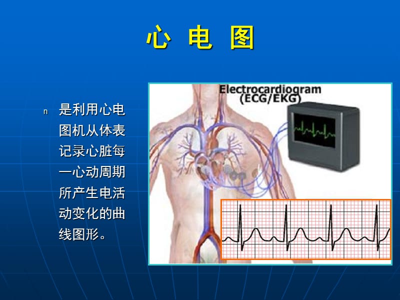 最新：正常心电图五年制-文档资料.ppt_第2页