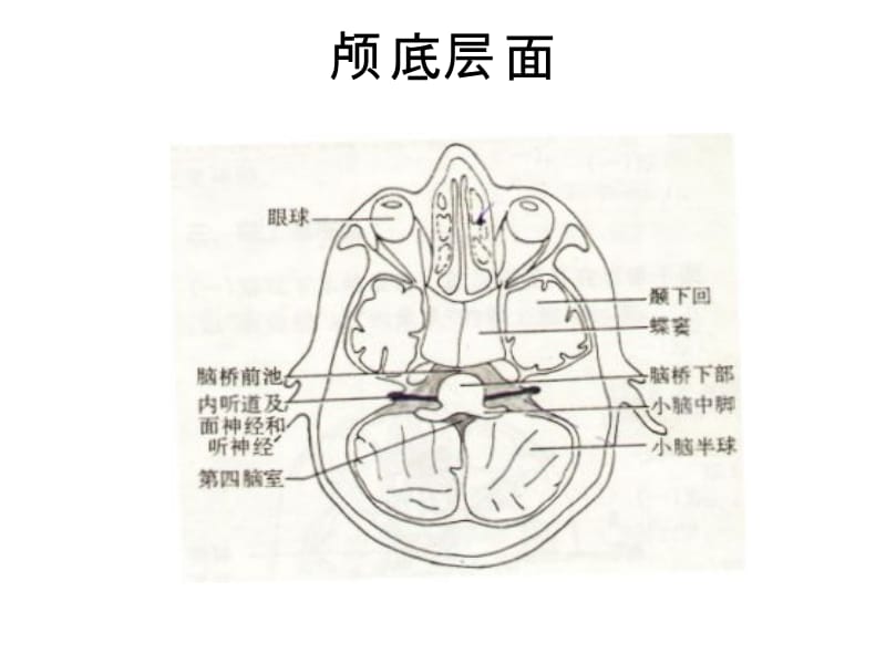 头颅CT示意图.ppt_第1页