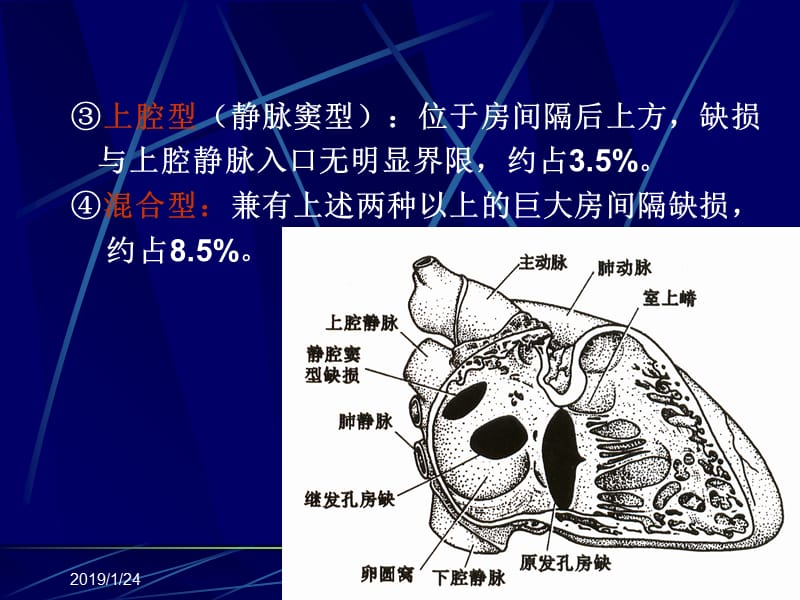 最新超声诊学一先天性心脏病课件-PPT文档.ppt_第2页