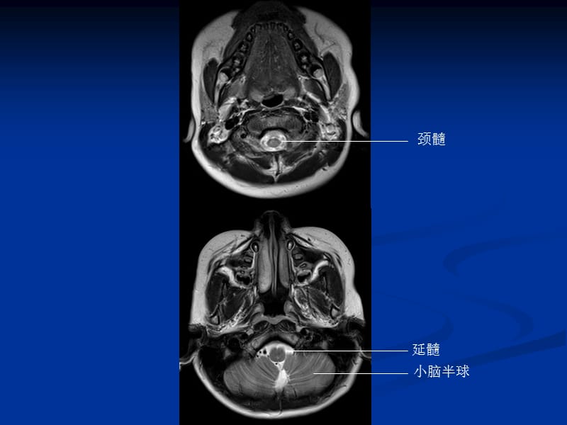 头颅CT和MRI的正常图像课件-PPT文档资料.ppt_第1页