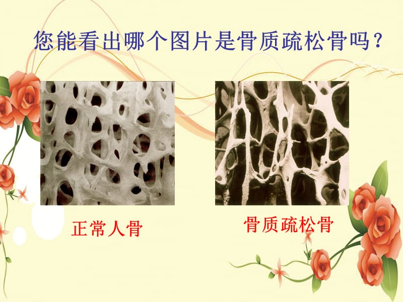 最新：专科护理学习骨质疏松ppt课件-文档资料.ppt_第2页