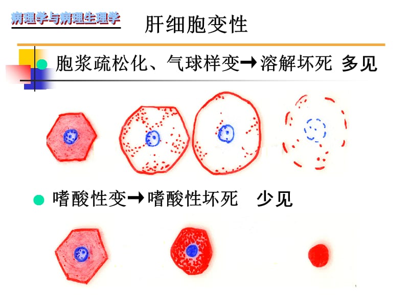 病毒性肝炎肝硬化-精选文档.ppt_第3页