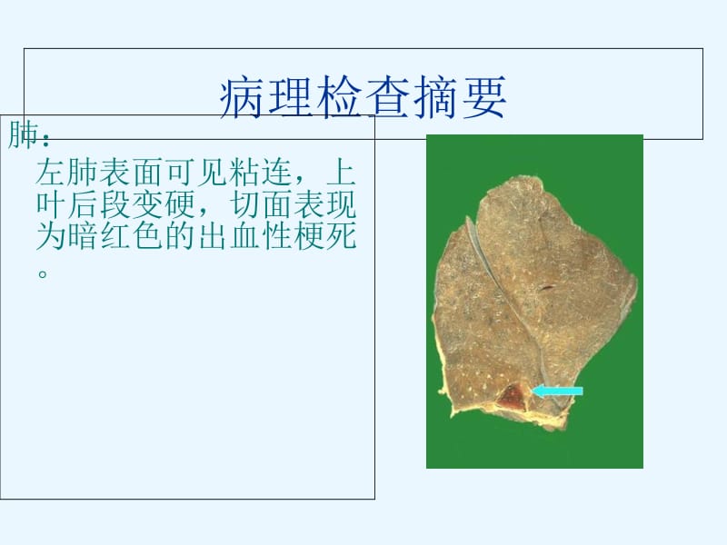 最新：呼吸系统疾病病例讨论（第2组）-文档资料.ppt_第2页