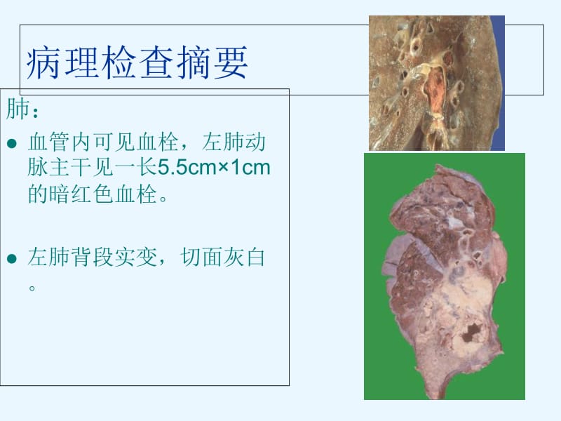 最新：呼吸系统疾病病例讨论（第2组）-文档资料.ppt_第3页