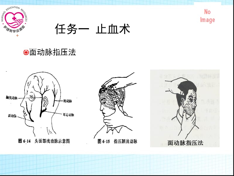 最新：急救护理课件习题及的答案04第四章 常用急救技术 第4节 外伤止血包扎固定搬运术-文档资料.ppt_第3页