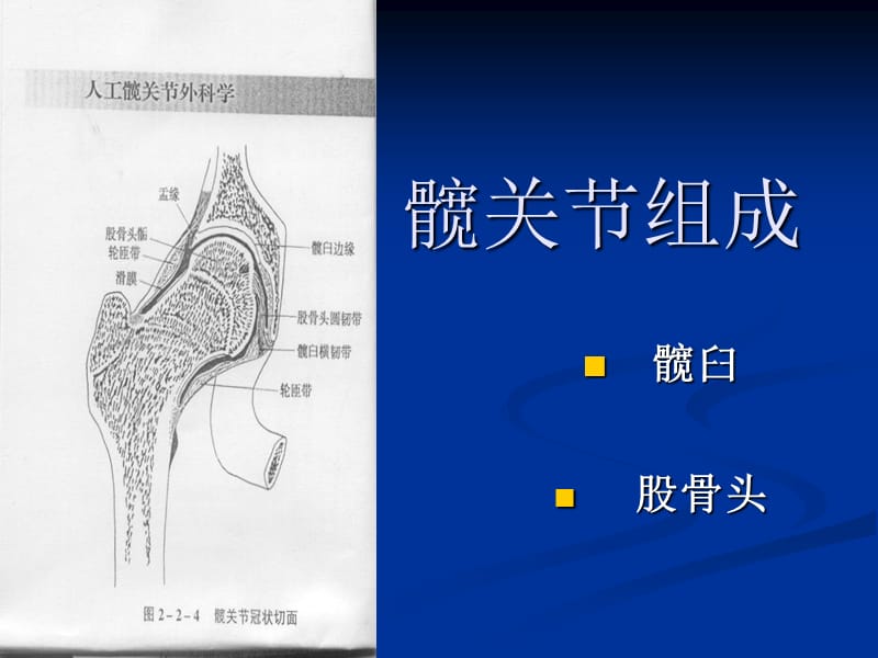 左股骨颈骨折的护理查房-PPT课件.ppt_第3页