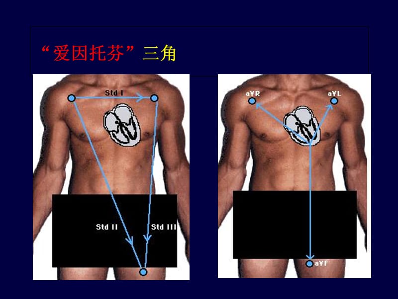 最新：心电图学教程-文档资料.ppt_第2页