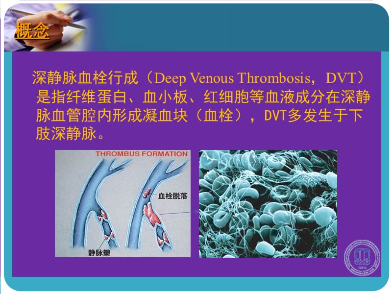 深静脉血栓形成的诊断和治疗指南-文档资料.ppt_第2页