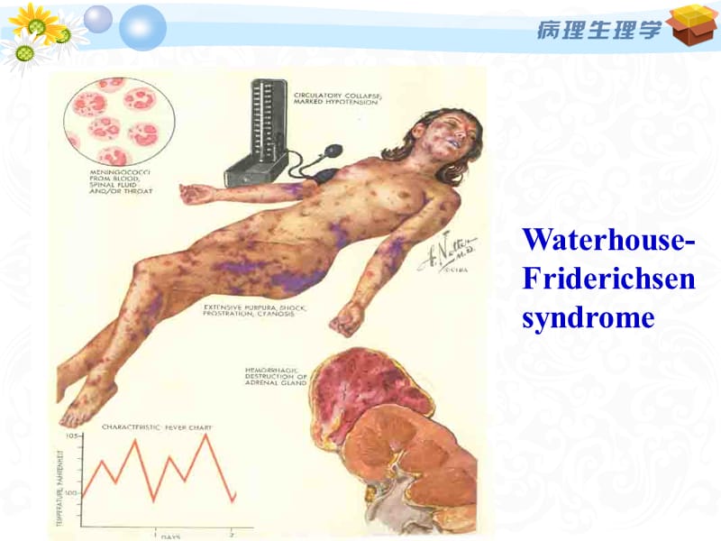 病理生理学DIC的案例版2015.11.2-精选文档.ppt_第2页