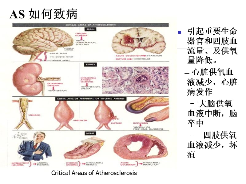 抗动脉粥样硬化药-PPT文档资料.ppt_第2页